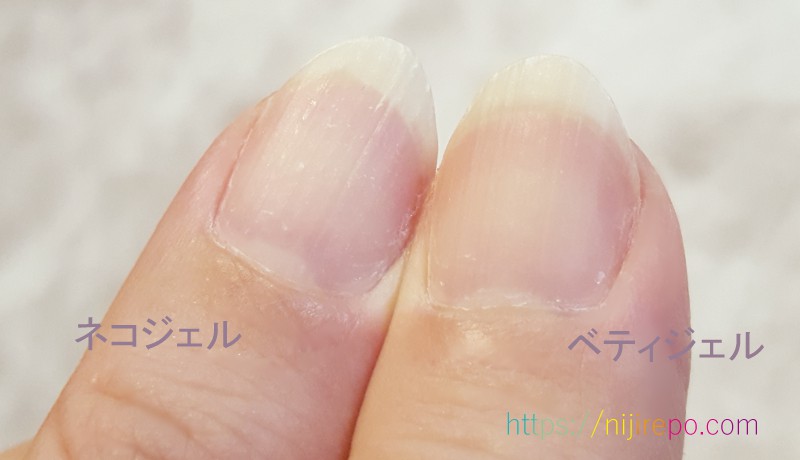 ネコジェルとベティジェルピールオフジェルを塗っていた爪の痛み比較